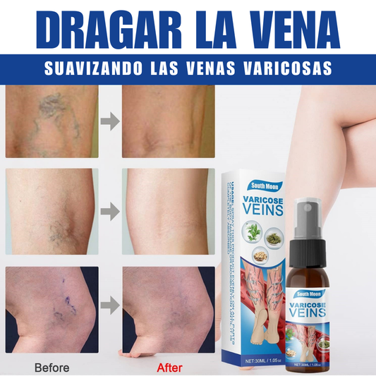 Varicose Veins Spray - ¡Adios Venas!