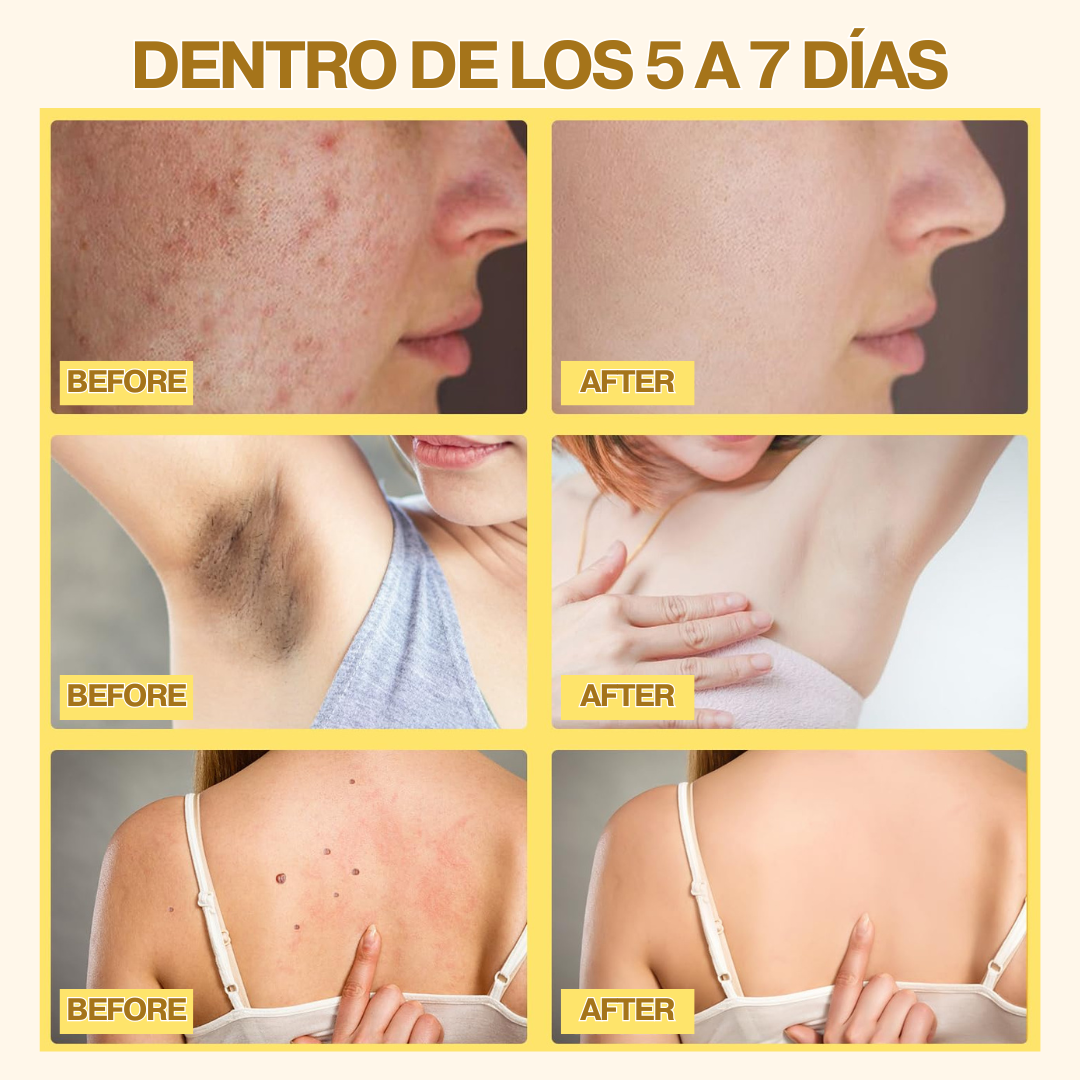 Combo Bee Venom Bswell + Botox Stock Solution