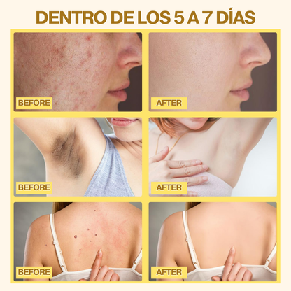 Combo Bee Venom Bswell + Botox Stock Solution