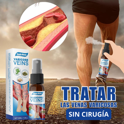 Varicose Veins Spray - ¡Adios Venas!
