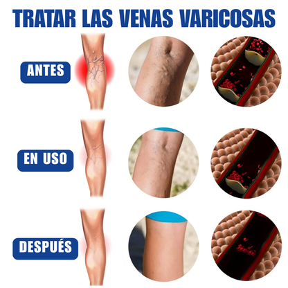 Varicose Veins Spray - ¡Adios Venas!