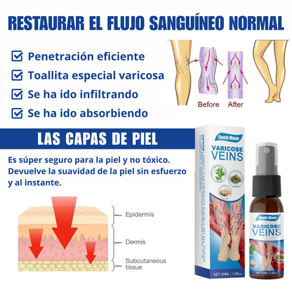 Varicose Veins Spray - ¡Adios Venas!
