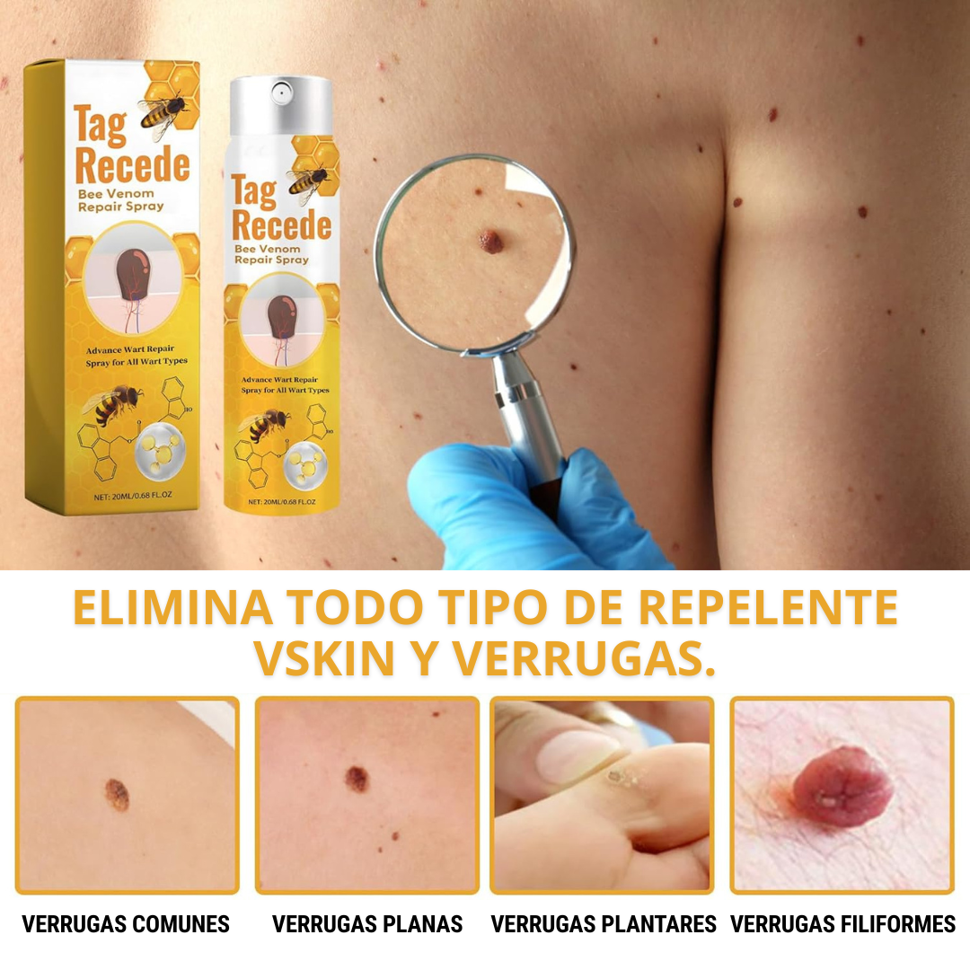 Eliminador de Verrugas Spray - Tag Recede