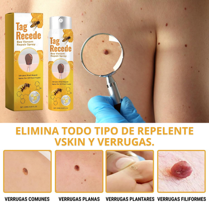 Eliminador de Verrugas Spray - Tag Recede