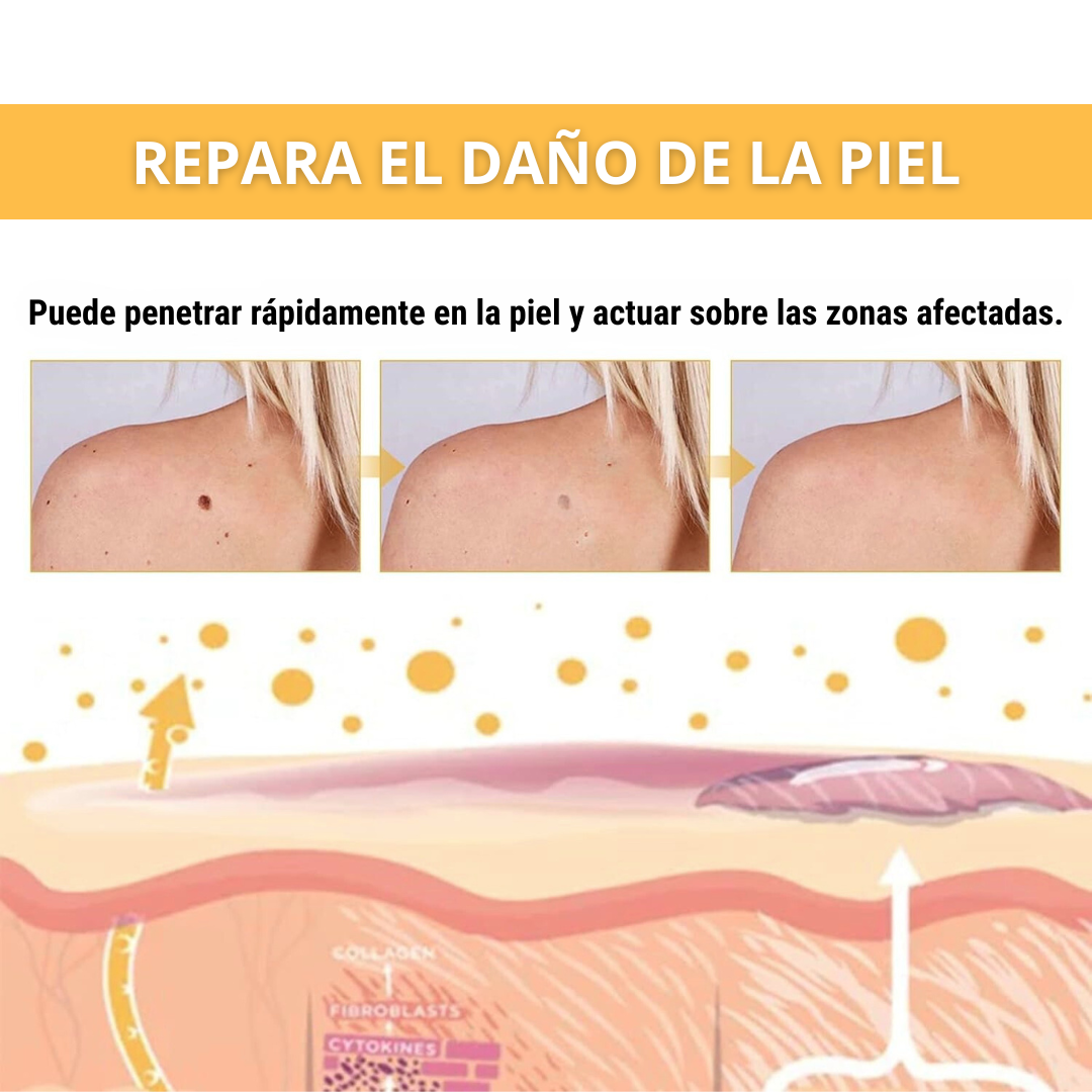 Eliminador de Verrugas Spray - Tag Recede