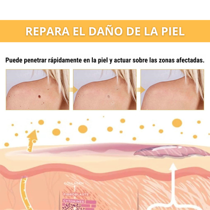 Eliminador de Verrugas Spray - Tag Recede