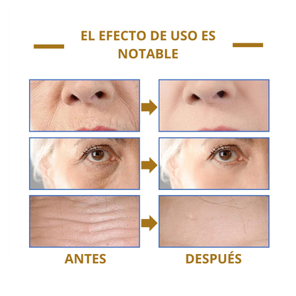 Combo Bee Venom Bswell + Botox Stock Solution