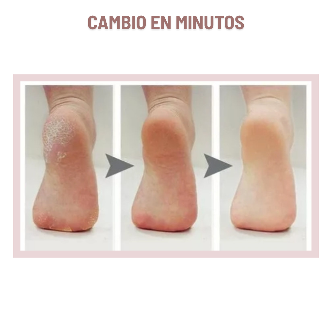 Eliminador de Callos Eléctrico para Pies