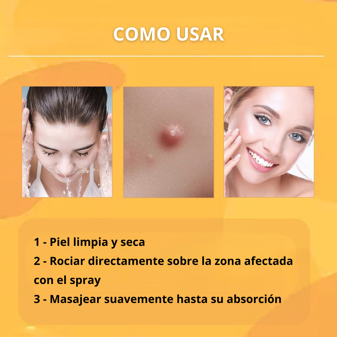 Eliminador de Verrugas Spray - Tag Recede